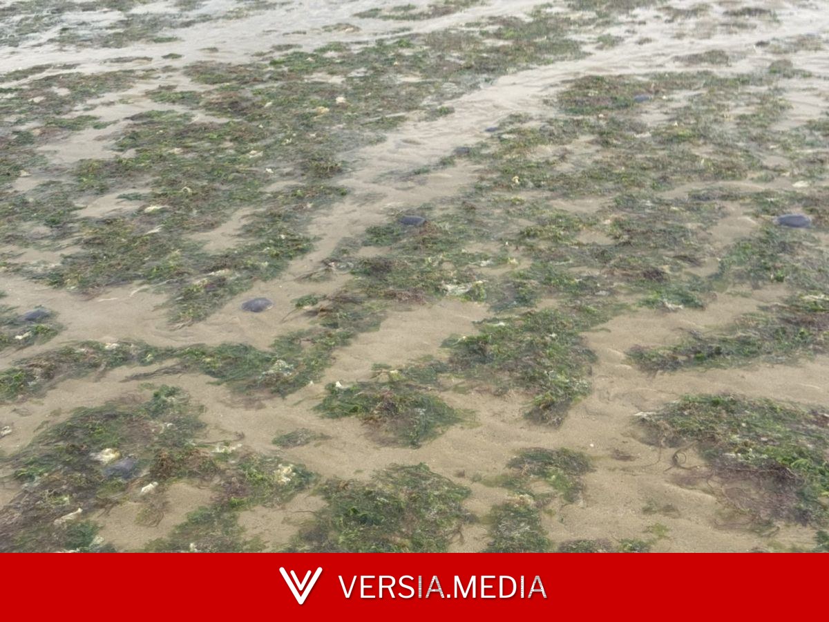 Des centaines de méduses sur les plages du Calvados